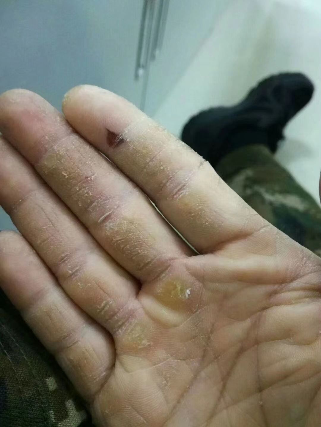手上的老茧